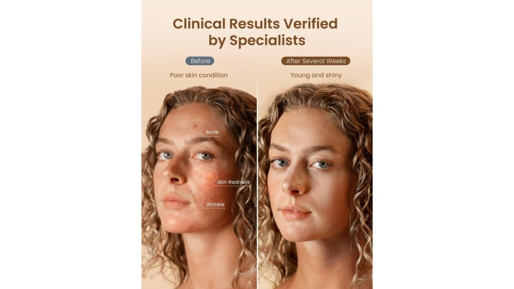 Prequel Skincare Explained: The Barrier-First Routine Your Skin Needs